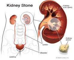 kidney graphic